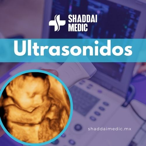 Ultrasonidos 2D, 3D, 4D y 5D. Disponibles en Shhadai Medic, la clínica médica en Escobedo, Nuevo León.